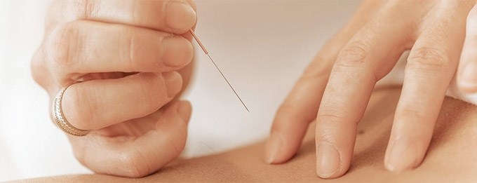 Hos Tikøb Akupunktur tilbydes akupunktur til kunder i Espergærde, Hornbæk, Helsingør og Humlebæk. Kontakt her.